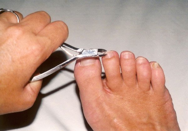Pedicure só é procurada quando o homem sente dor (foto: Karen Winton/ stock.xchng)