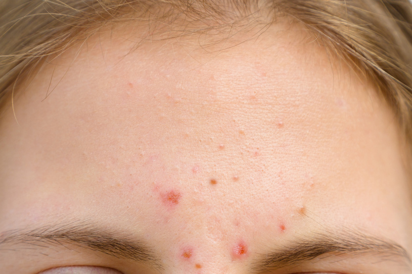 Foto: lavizzara/Fotolia